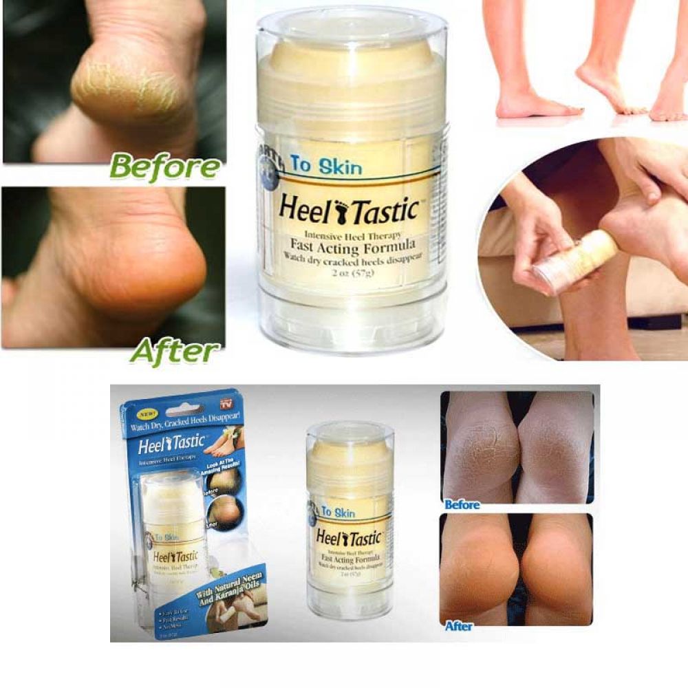 New Heel Tastic Intensive Heel Therapy